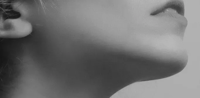 kybella-1