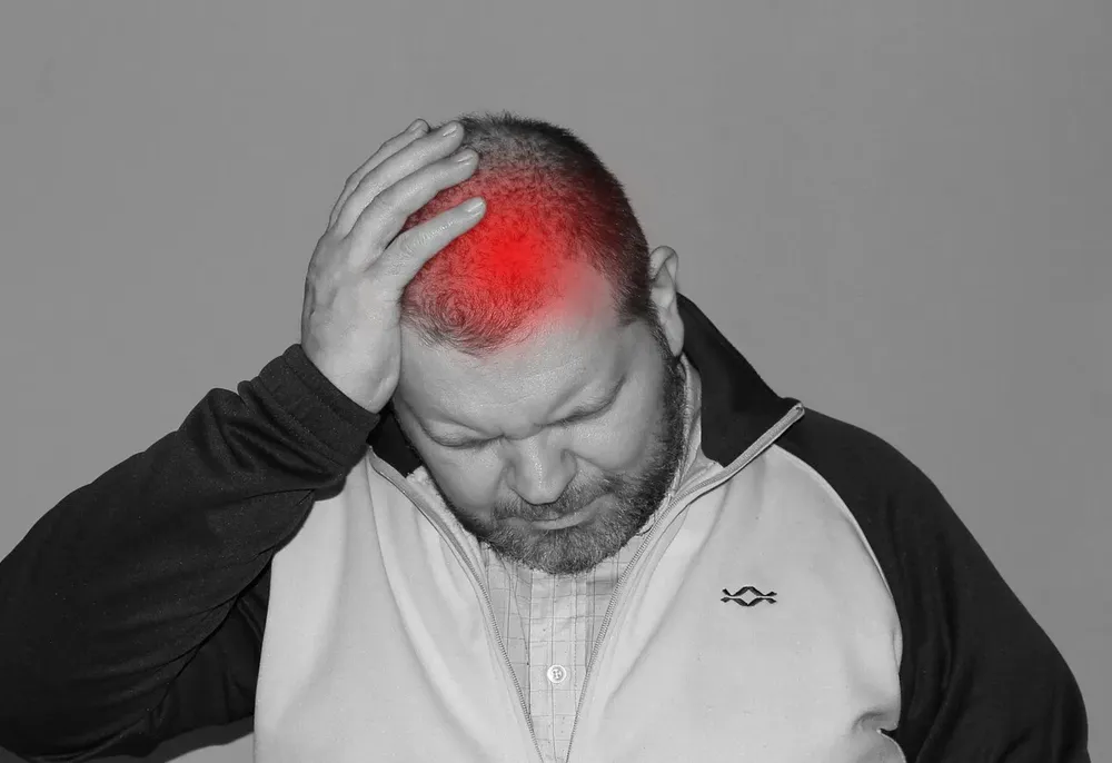 Botox for migraines