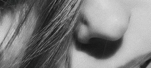 kybella-2