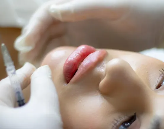 bad-lip-injections-1-1