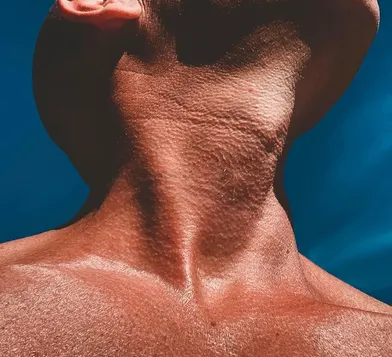 botox jawline