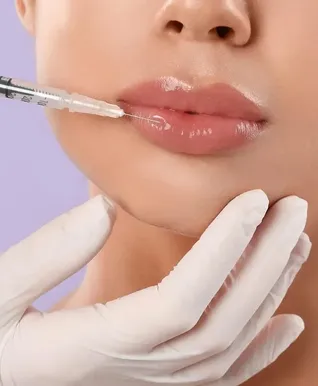 botox-for-smokers-lines-before-and-after-2