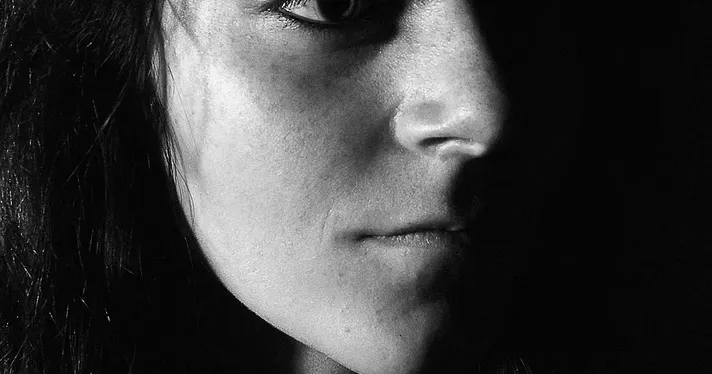 botox-eyebrow-lift
