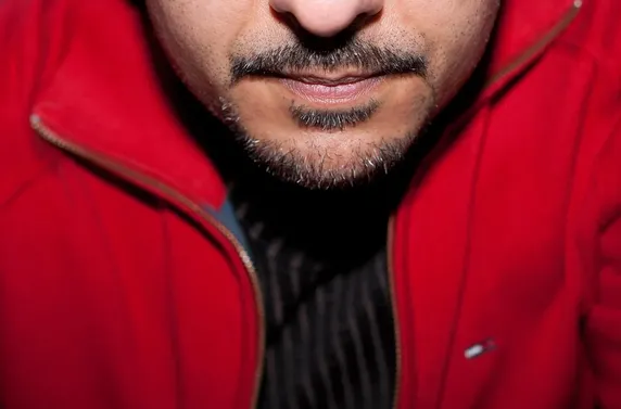 chin thinning with botox 1