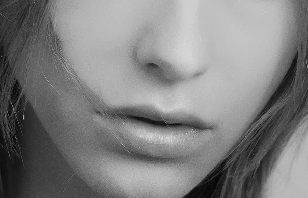chin botox 1