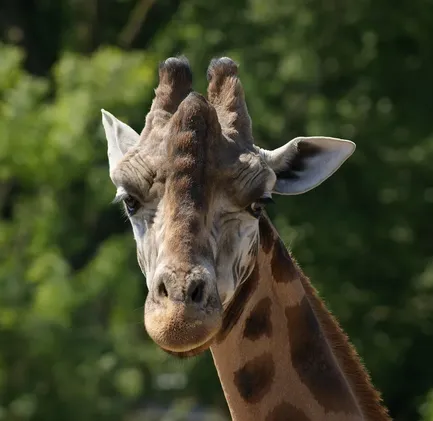 botox-for-neck-2