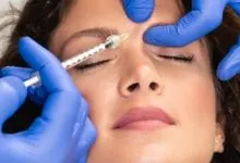 botox-for-crow's-feet-before-and-after-1