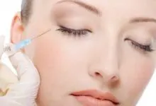 bruising-after-botox-around-eyes