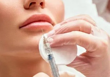 bruising-after-fillers-under-eyes-1