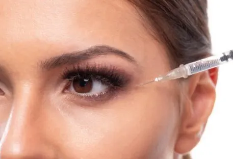 bruising-after-fillers-under-eyes-2