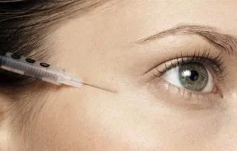 bruising-after-fillers-under-eyes