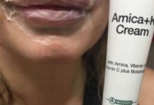 how much arnica to take before fillers 1