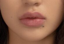 lip-injections-near-me