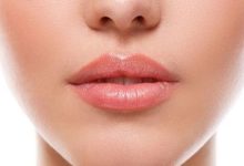 lip-swellings-1