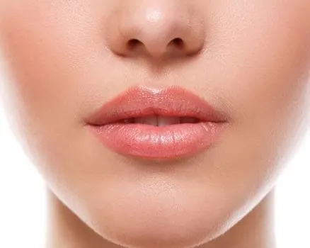 lip-swellings-1