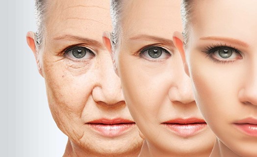 the-anti-aging-benefits-of-botox-1