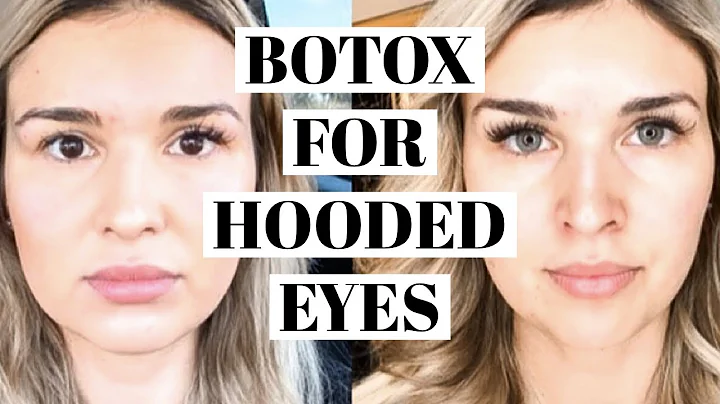 Can botox help hooded eyes