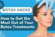 Tips for quick recovery from Botox bruising