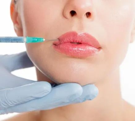bruised-lips-from-botox-1 bruised-lips-from-botox-1