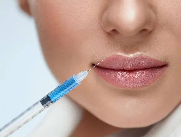 bruised-lips-from-botox bruised-lips-from-botox