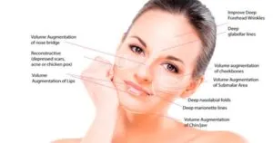dermal-fillers-1