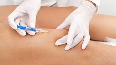 dermal-fillers-for-knees-1