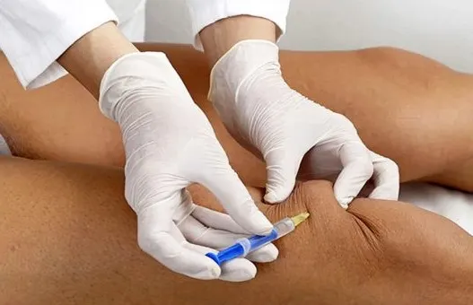 dermal-fillers-for-knees-2