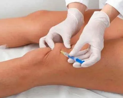 dermal-fillers-for-knees
