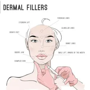dermal-fillers