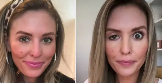 best-botox-near-me